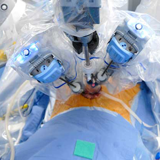 Robotic Surgeon in Mumbai